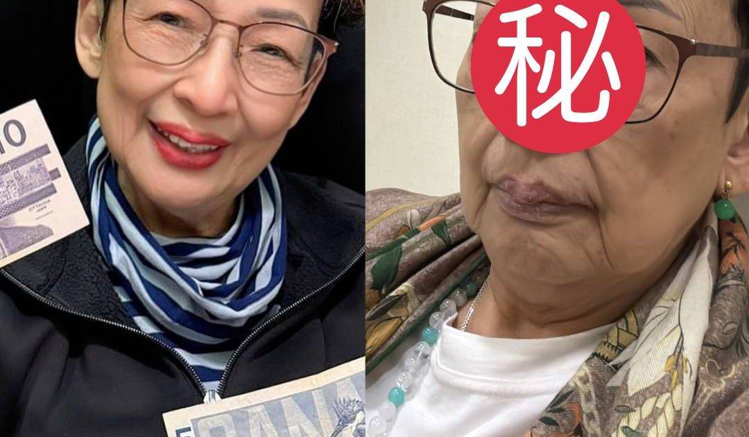 82歲馮素波凌晨3點突報病訊 晒三張素顏近照顯疲態 網民湧入留言慰問