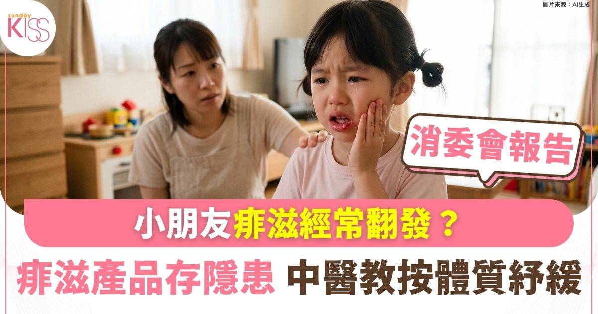 小朋友痱滋經常翻發？ 痱滋產品成分恐灼傷口腔 中醫教按4類體質紓緩